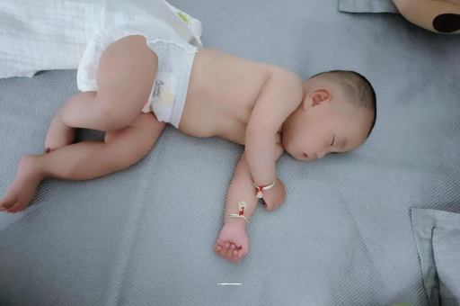 宣汉六个月宝宝眼睛散光